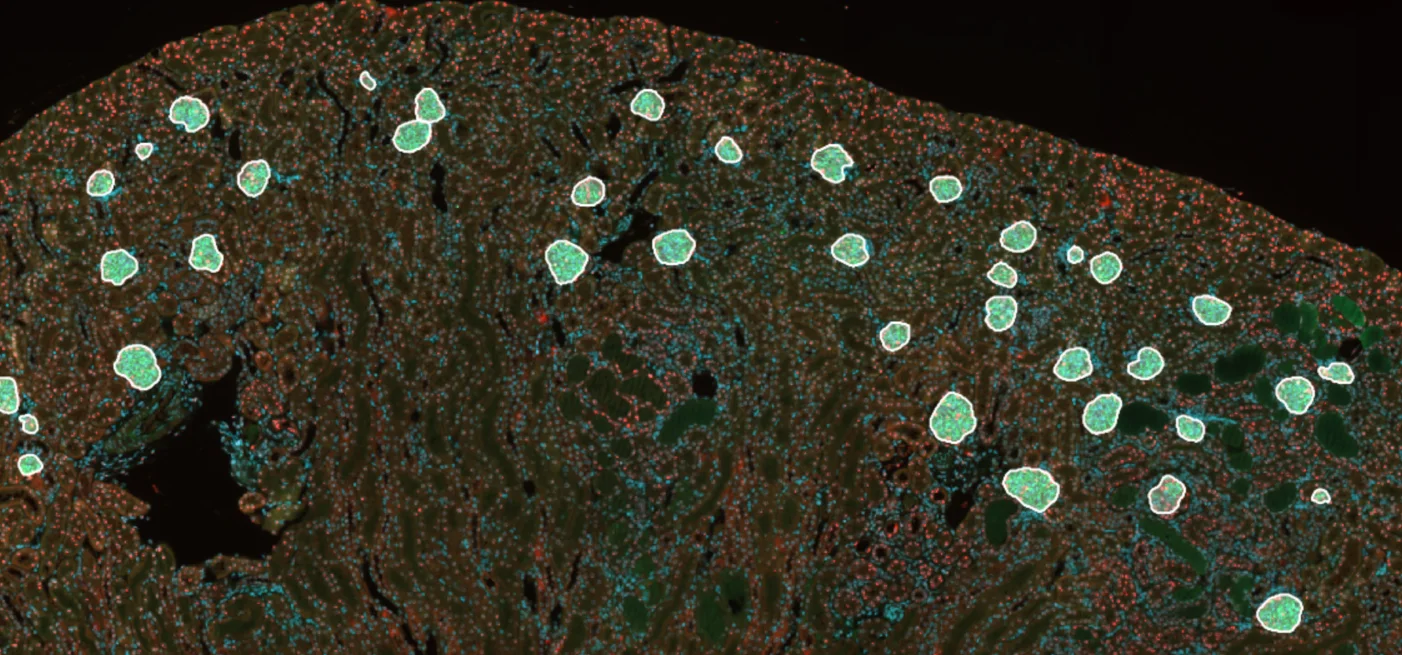 Image source de coupe de rein en fluorescence