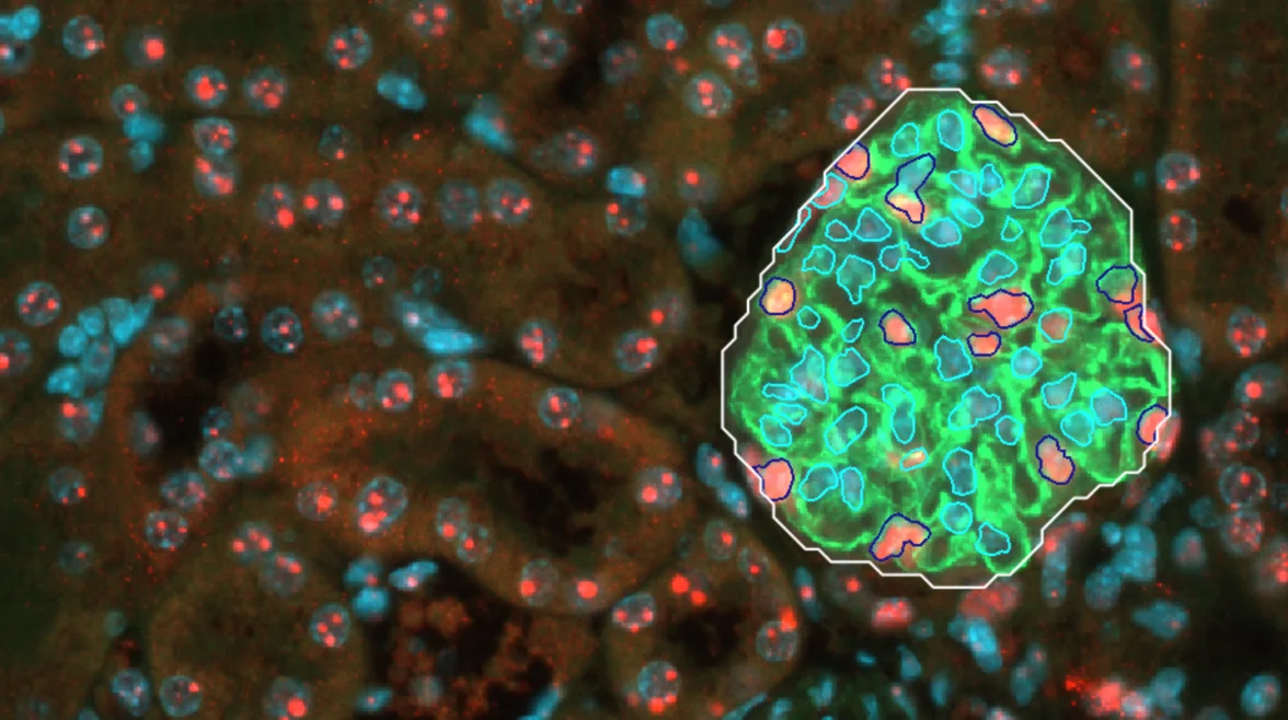 Segmentation glomérulaire et podocytaire