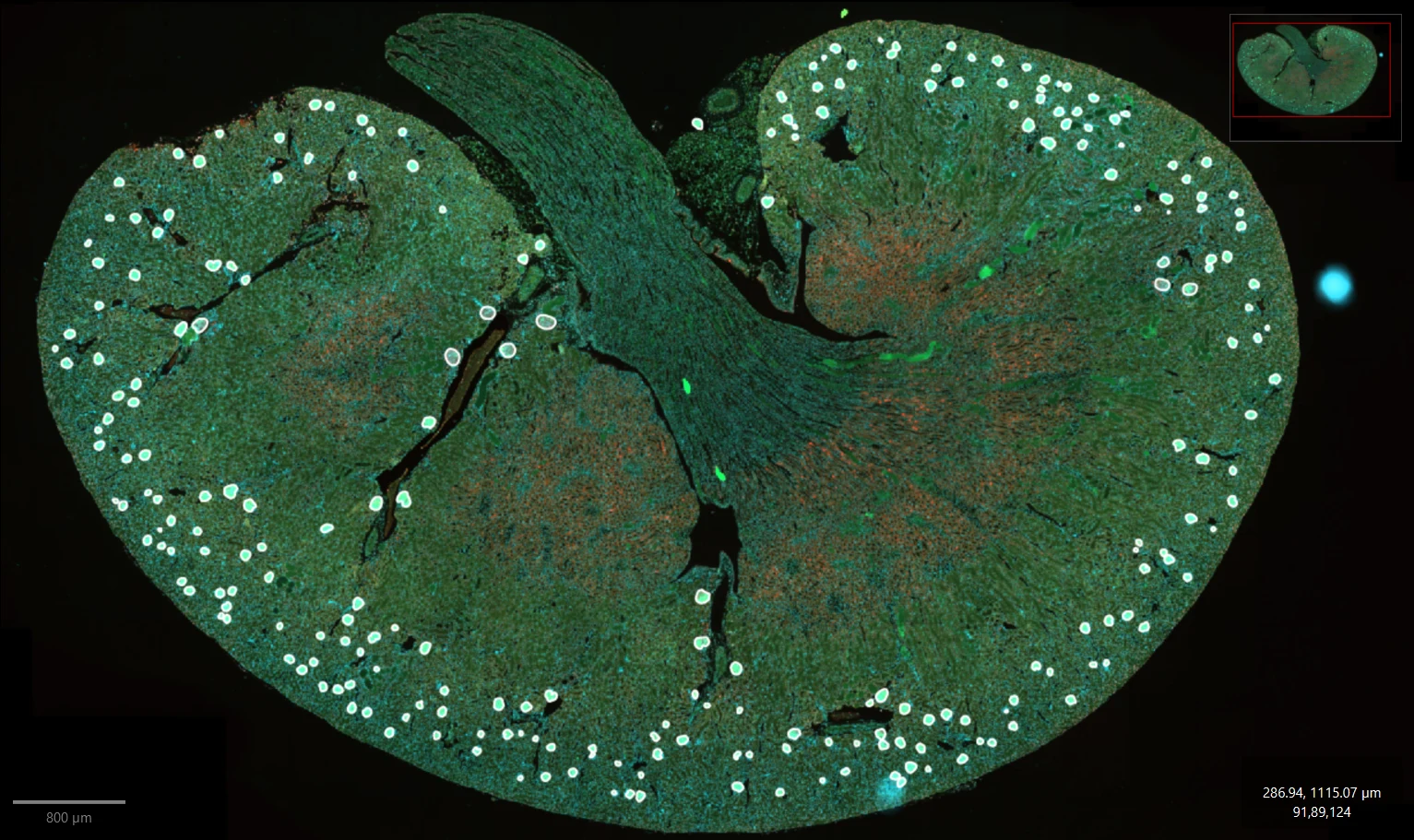 Image biologique après traitement