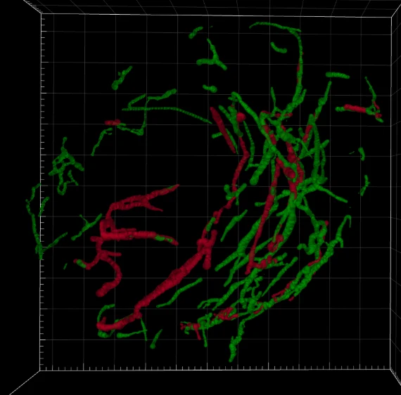 Scan 3D d'organoïde après segmentation