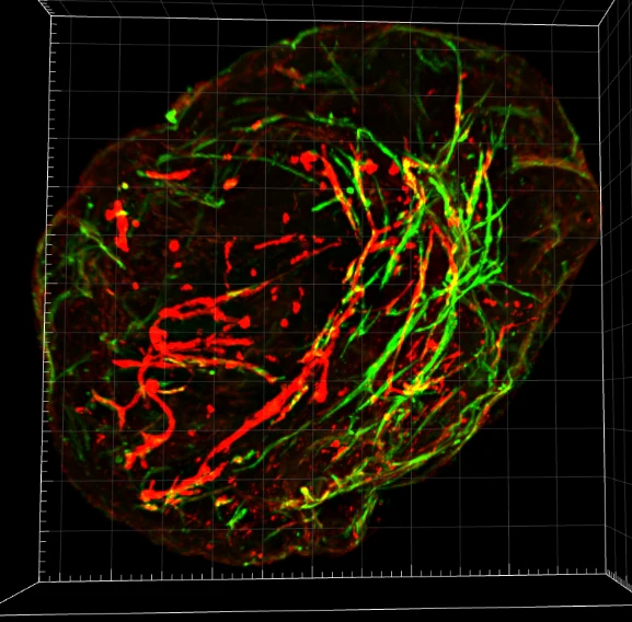 Scan 3D d'organoïde avant segmentation