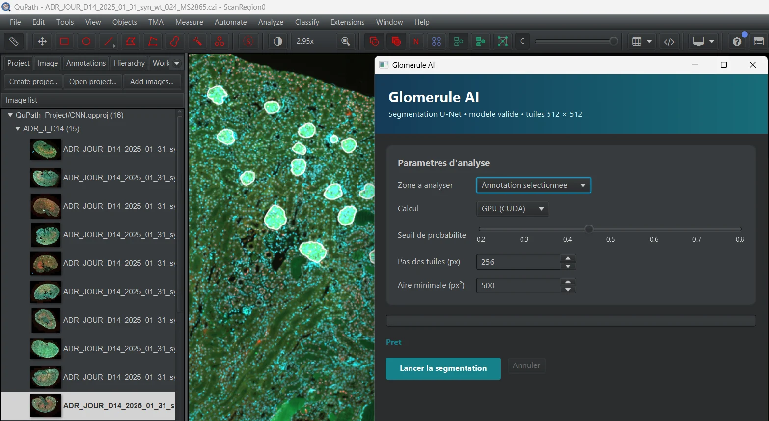 Exemple de création d'extension et workflow d'analyse
